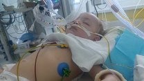 Dvouletý chlapec vdechl kus hrušky, je v kómatu. Naději na uzdravení dává sbírka
